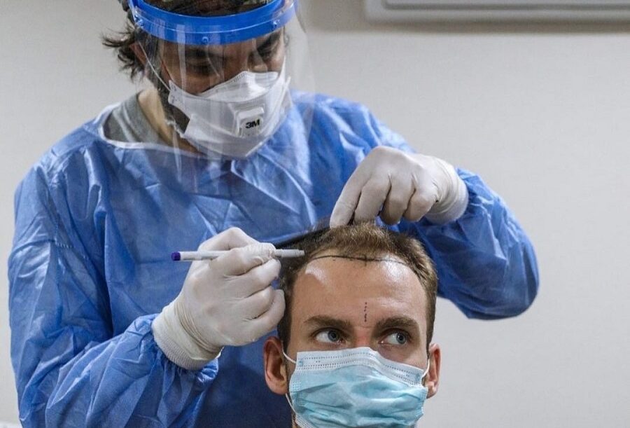 Docteur Cinik, docteur spécialiste de la greffe de cheveux en Turquie