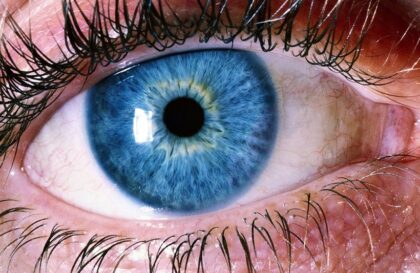 lentilles-contact-conseils