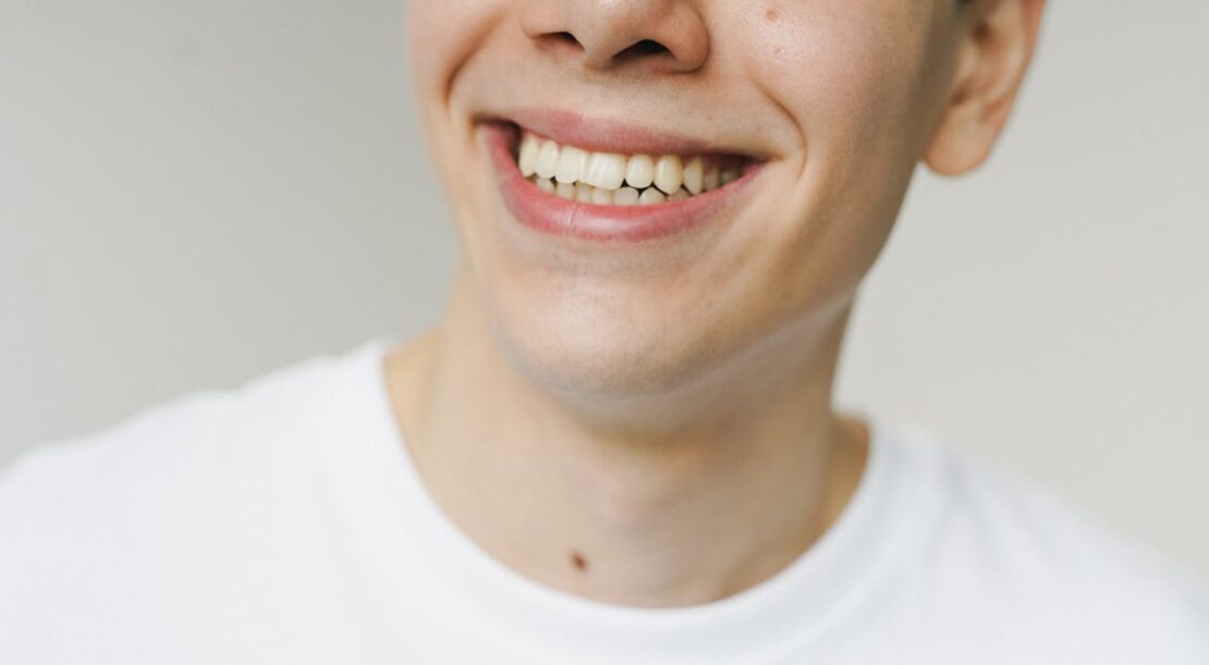 blanchiment dentaire