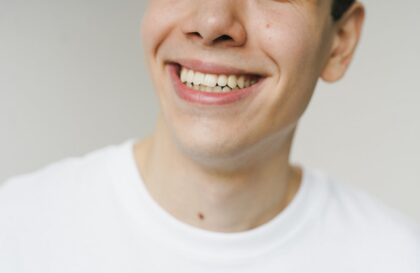 blanchiment dentaire